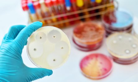 Antimicrobial Susceptibility Testing Market