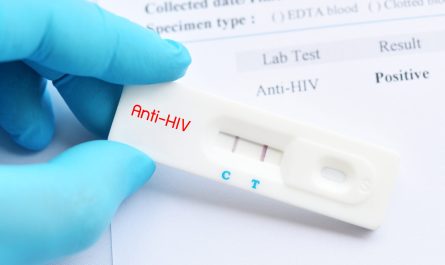 Asia Pacific HIV Diagnostics Market