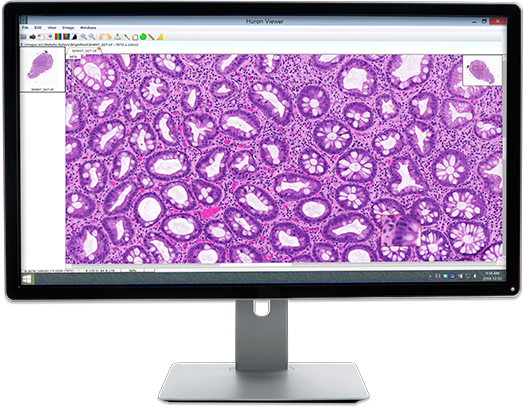 Digital Pathology Market Is Estimated To Witness High Growth Owing To Increasing Demand for Remote Diagnosis