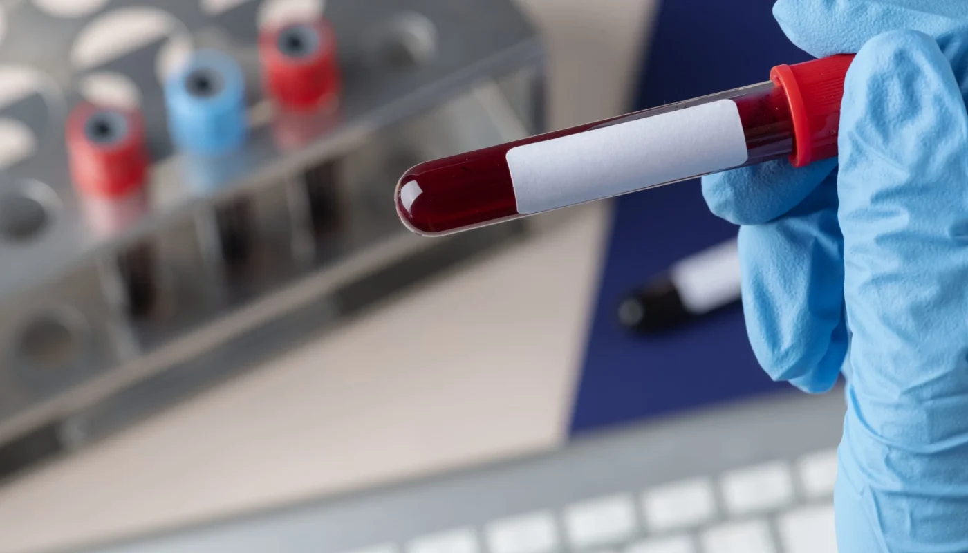 Revolutionary Blood Test Offers Early Cancer Detection for Li-Fraumeni Syndrome Patients