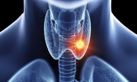 Rising Levels of Thyroid Cancer