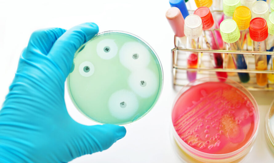 Antimicrobial Susceptibility Testing Market is Estimated To Witness High Growth Owing To Increasing Prevalence of Infectious Diseases