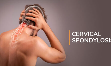 Cervical Spondylosis Treatment Market