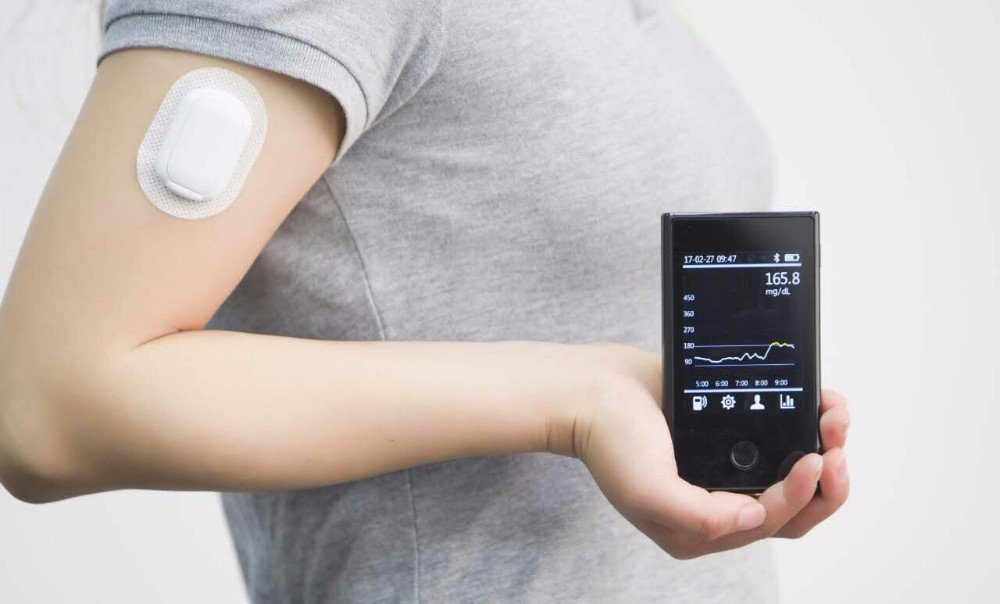 China Continuous Glucose Monitoring Devices Market