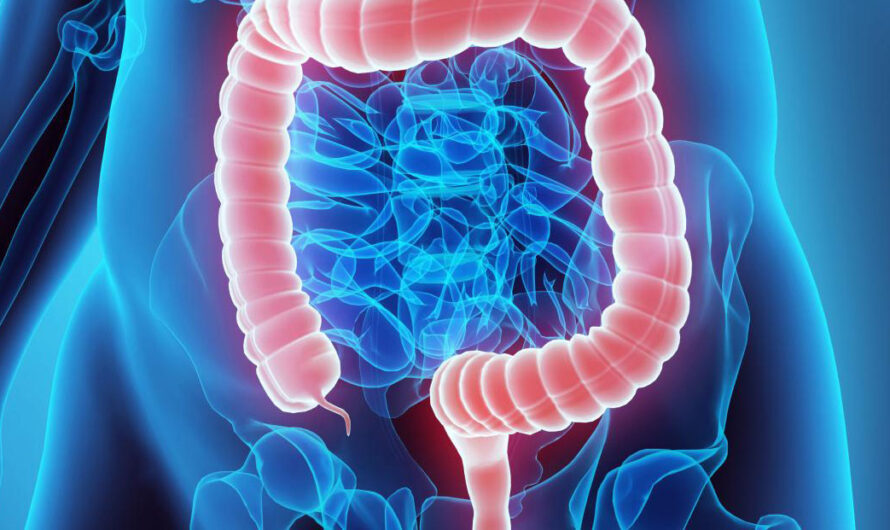 Colorectal Cancer Screening Market Is Expected To Be Flourished By Growing Awareness Of Colorectal Cancer Screening