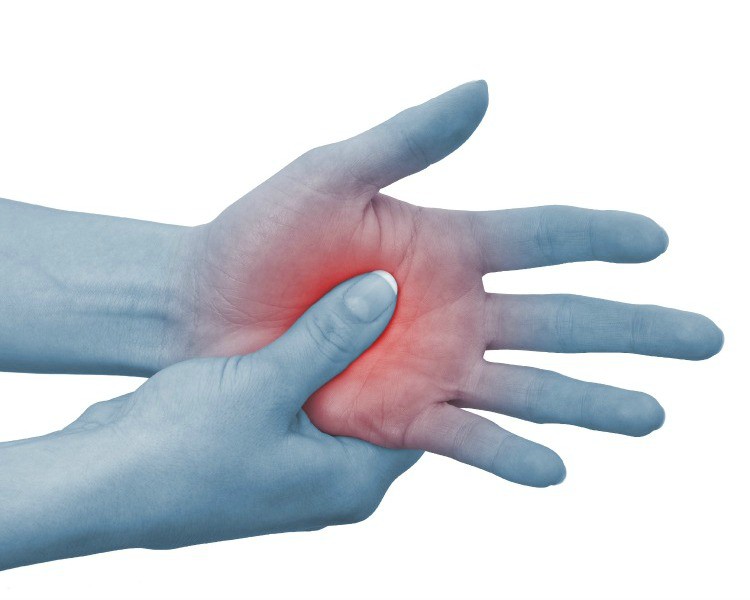 Complex Regional Pain Syndrome Market