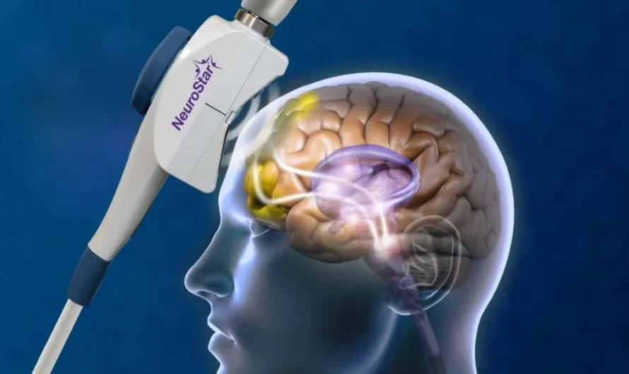 Transcranial Magnetic Stimulation – A Revolutionary Brain Treatment