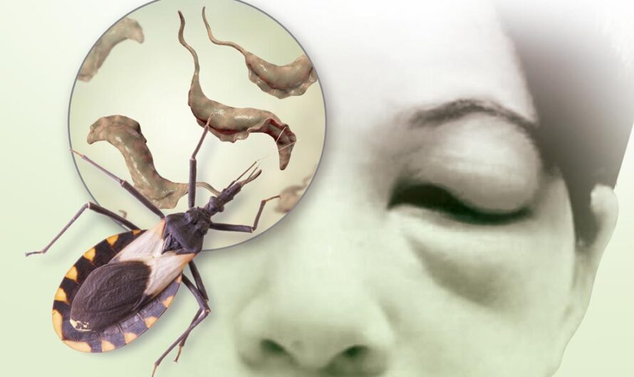 Chagas Disease Treatment Market Driven by Advancements in Diagnostic and Therapeutic Technologies