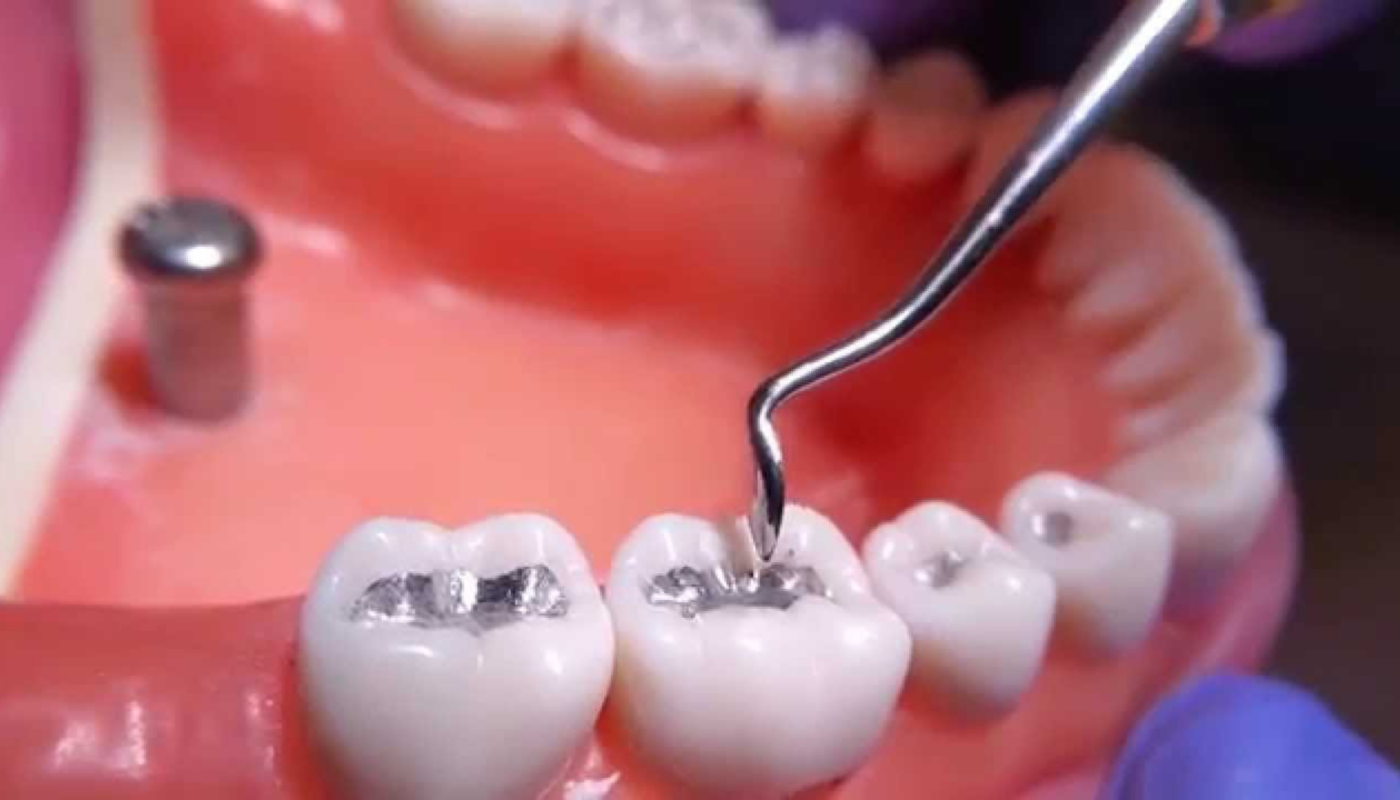 Dental Amalgam Separator