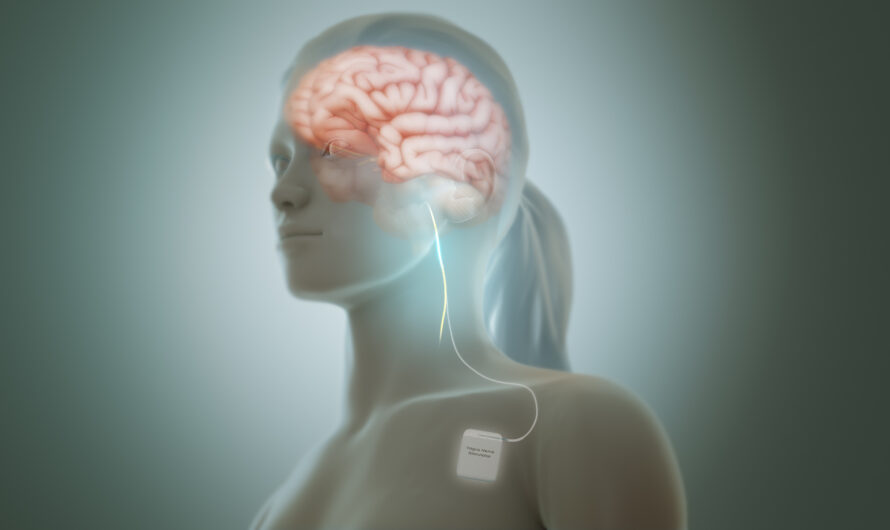 Vagus Nerve Stimulators: An Emerging Treatment Option for Seizures