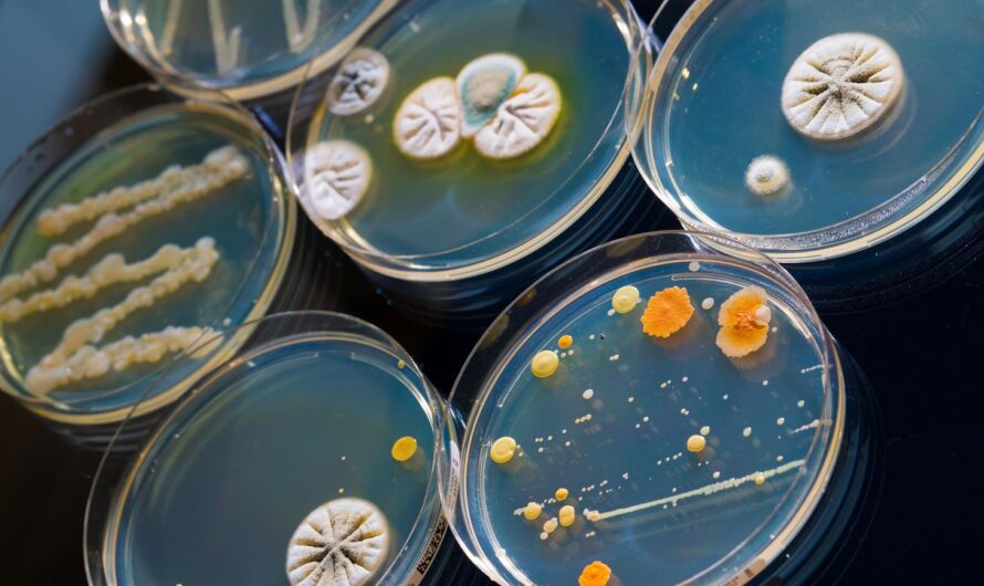 Bacterial Colony Counters Market is Estimated to Witness High Growth Owing to Growing Adoption of Automated Counters